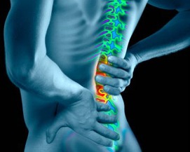 Sciatica therapy, San Clemente Chiropractic, Dr. Tyler Johnson